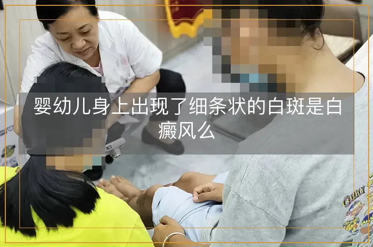 婴幼儿身上出现了细条状的白斑是白癜风么