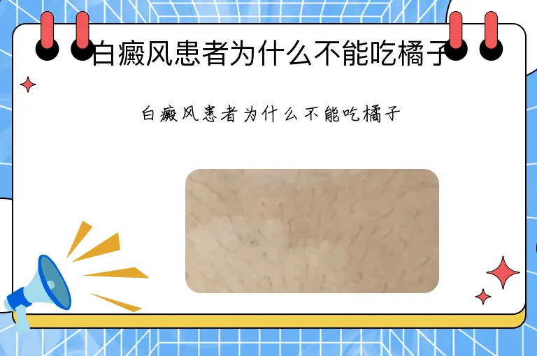 白癜风患者为什么不能吃橘子