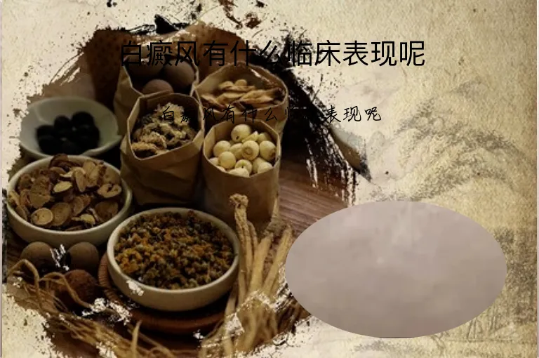 白癜风有什么临床表现呢