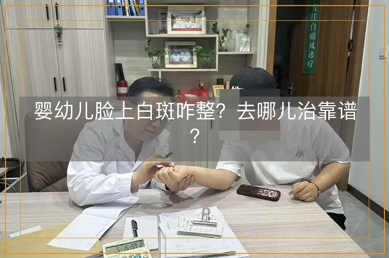 婴幼儿脸上白斑咋整？去哪儿治靠谱？