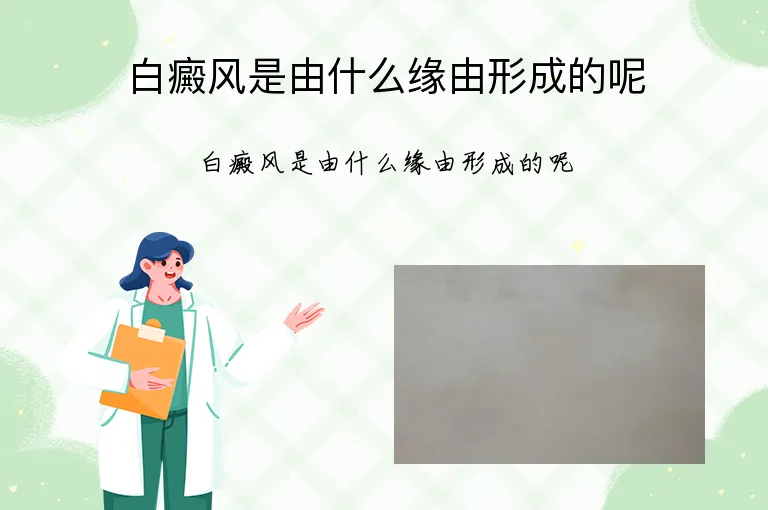 白癜风是由什么缘由形成的呢