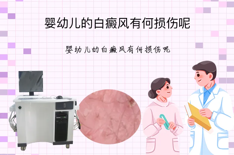 婴幼儿的白癜风有何损伤呢