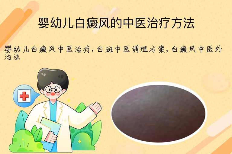 婴幼儿白癜风的中医治疗方法