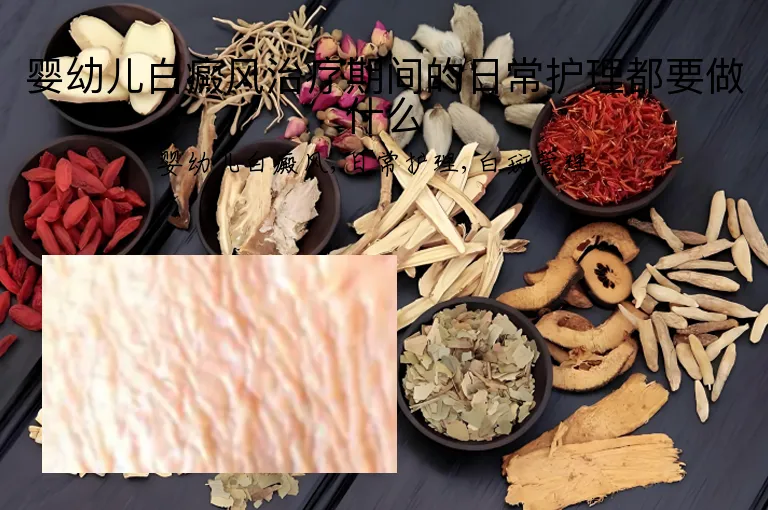 婴幼儿白癜风治疗期间的日常护理都要做什么