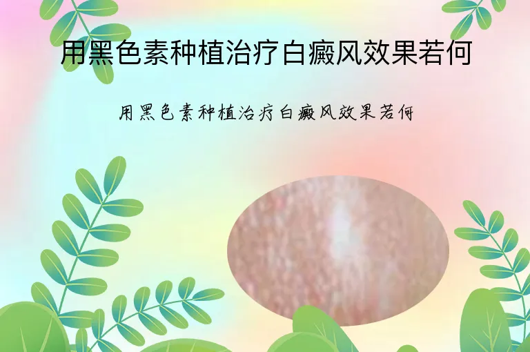 用黑色素种植治疗白癜风效果若何