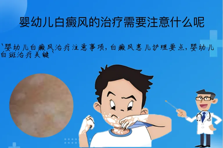 婴幼儿白癜风的治疗需要注意什么呢