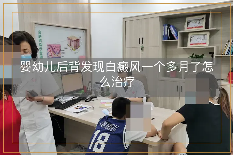 婴幼儿后背发现白癜风一个多月了怎么治疗