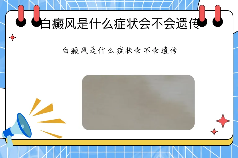 白癜风是什么症状会不会遗传