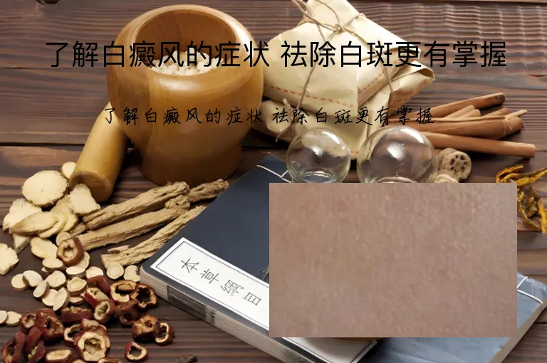 了解白癜风的症状 祛除白斑更有掌握
