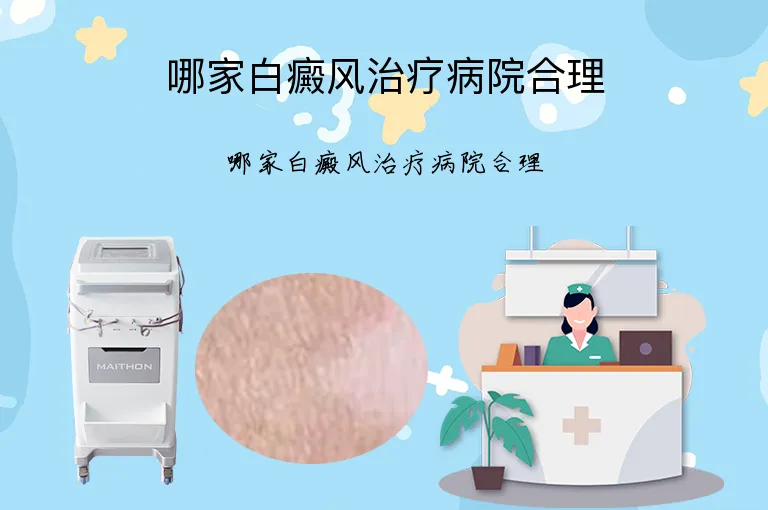 哪家白癜风治疗病院合理