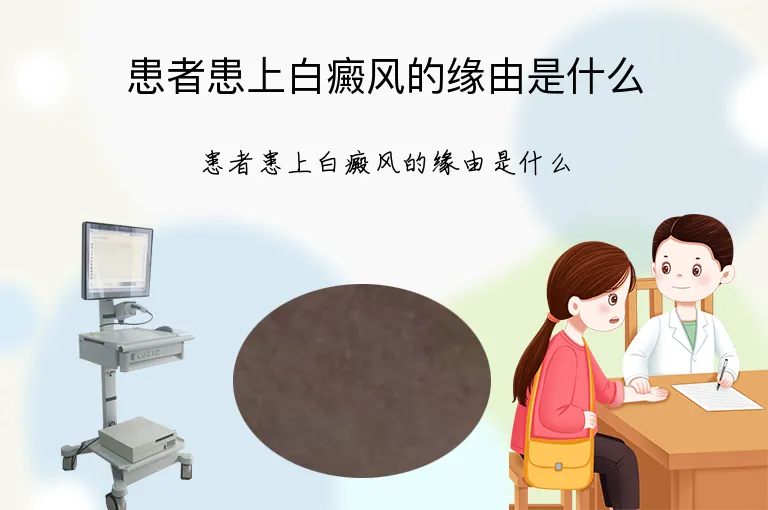 患者患上白癜风的缘由是什么