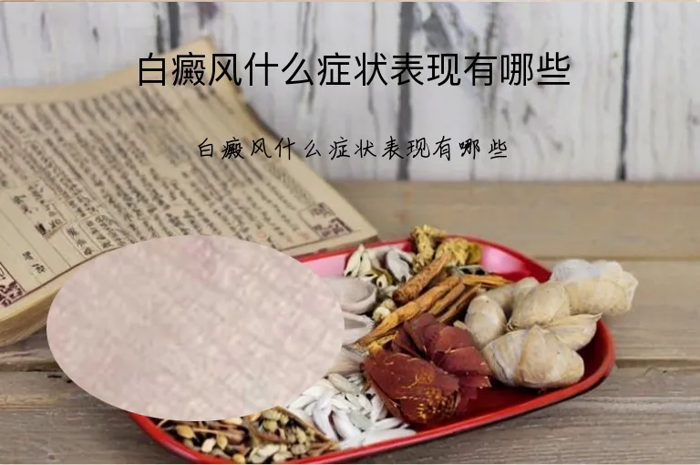 白癜风什么症状表现有哪些