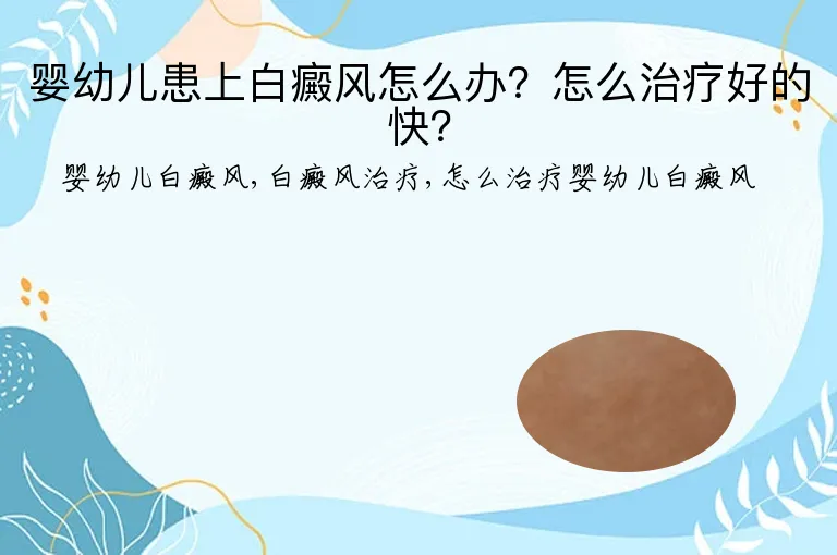 婴幼儿患上白癜风怎么办？怎么治疗好的快？