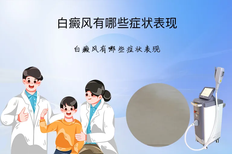 白癜风有哪些症状表现