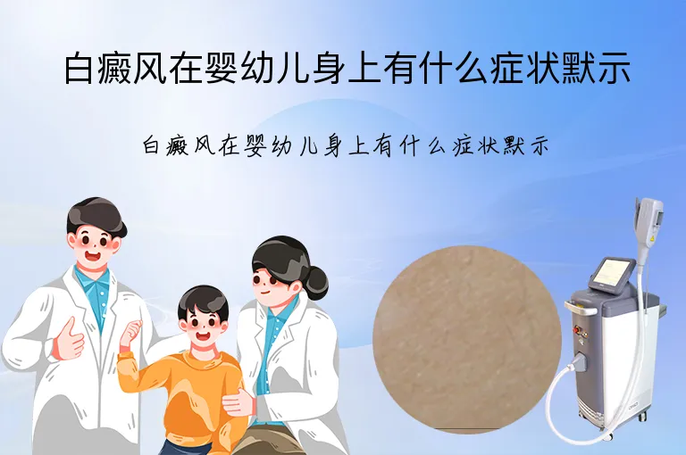 白癜风在婴幼儿身上有什么症状默示