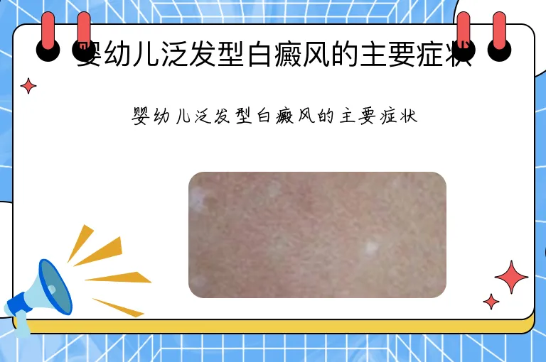 婴幼儿泛发型白癜风的主要症状