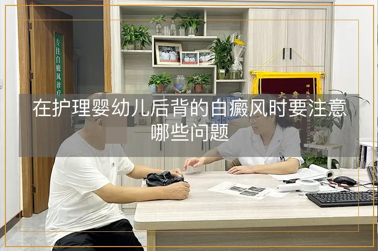 在护理婴幼儿后背的白癜风时要注意哪些问题