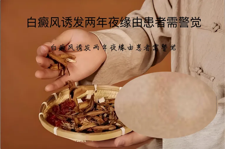 白癜风诱发两年夜缘由患者需警觉