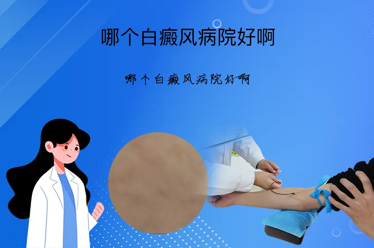 哪个白癜风病院好啊