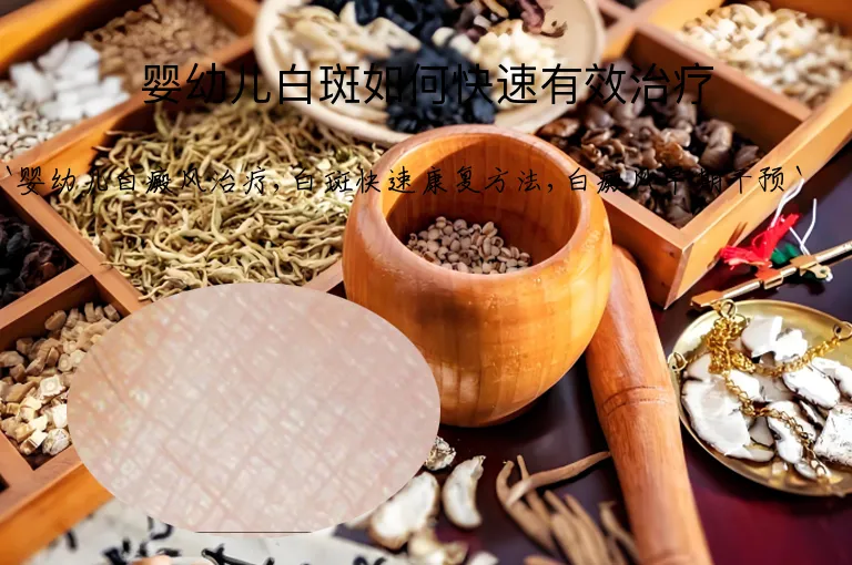 婴幼儿白斑如何快速有效治疗