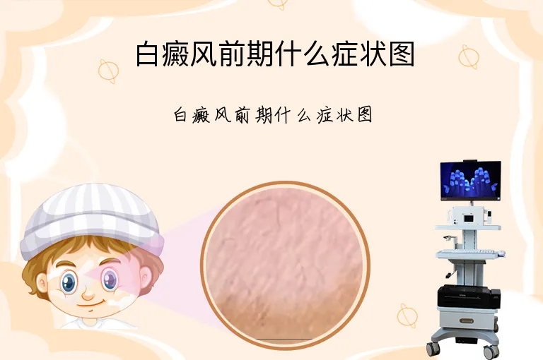 白癜风前期什么症状图