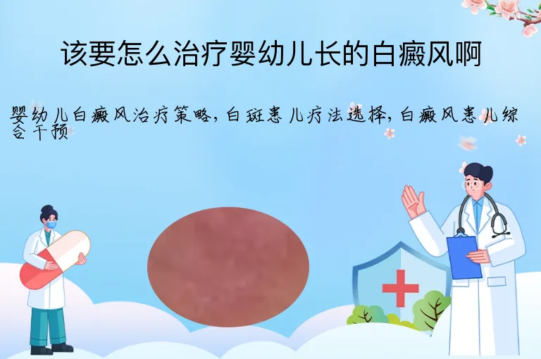 该要怎么治疗婴幼儿长的白癜风啊