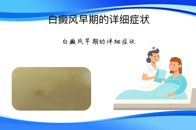 白癜风早期的详细症状