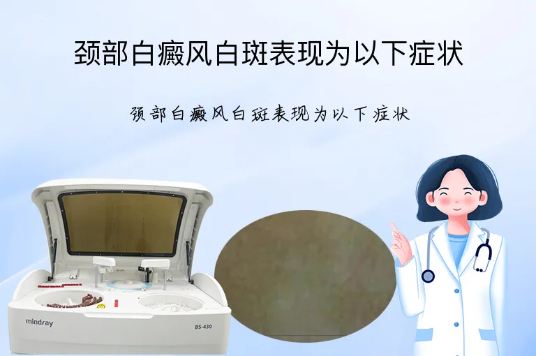颈部白癜风白斑表现为以下症状