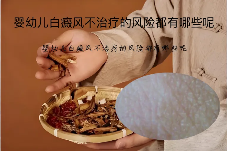 婴幼儿白癜风不治疗的风险都有哪些呢