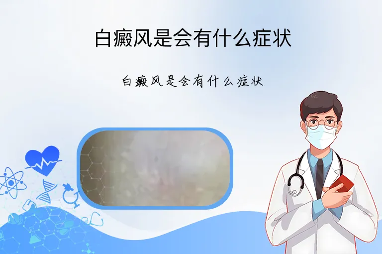 白癜风是会有什么症状