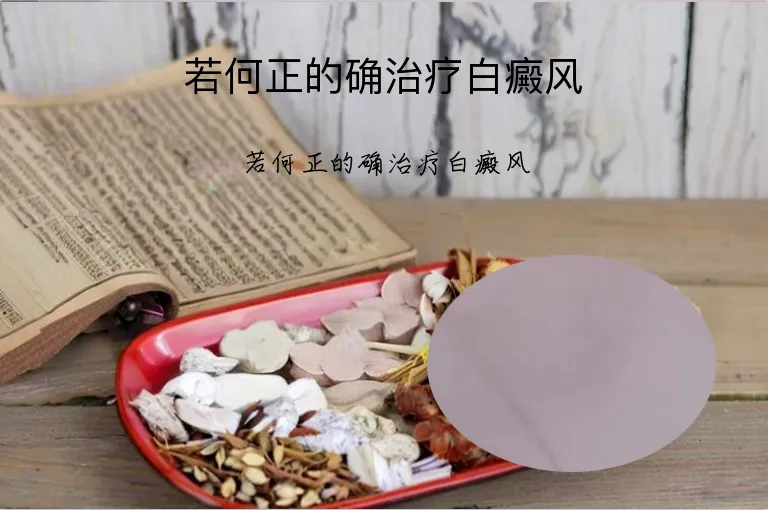 若何正的确治疗白癜风