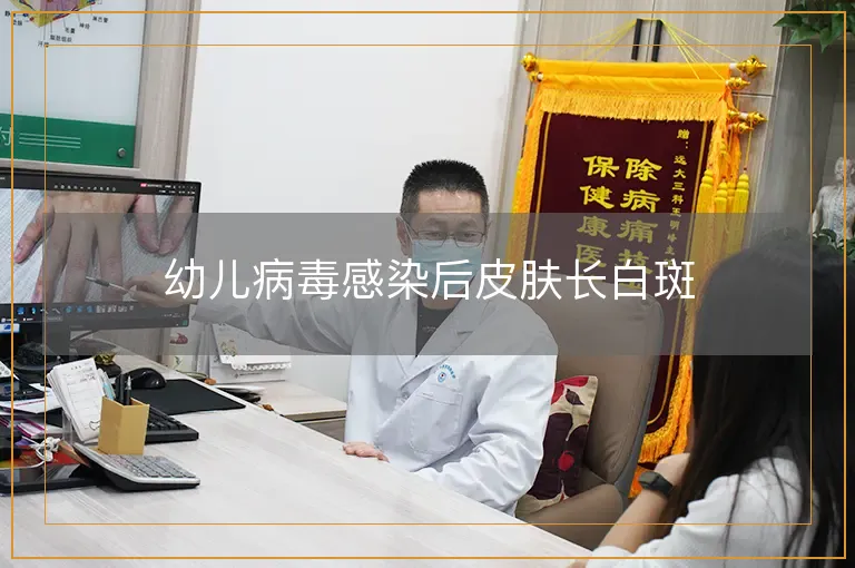 幼儿病毒感染后皮肤长白斑