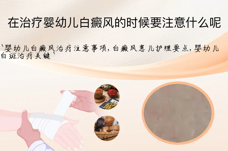 在治疗婴幼儿白癜风的时候要注意什么呢