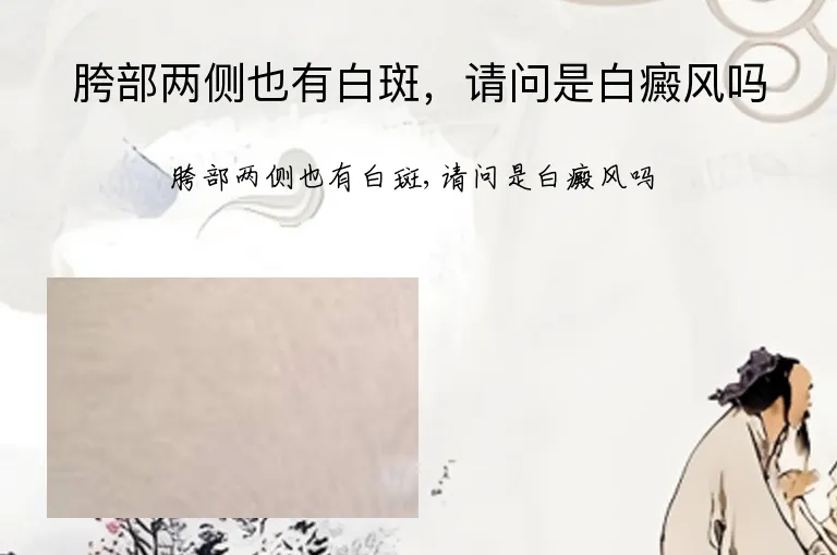 胯部两侧也有白斑，请问是白癜风吗