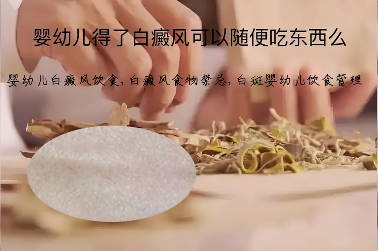 婴幼儿得了白癜风可以随便吃东西么