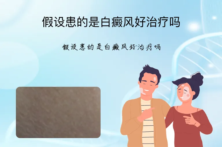 假设患的是白癜风好治疗吗