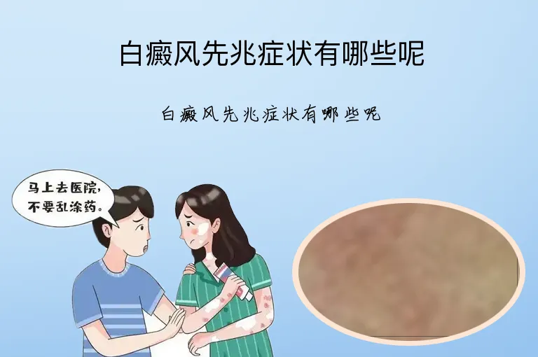 白癜风先兆症状有哪些呢
