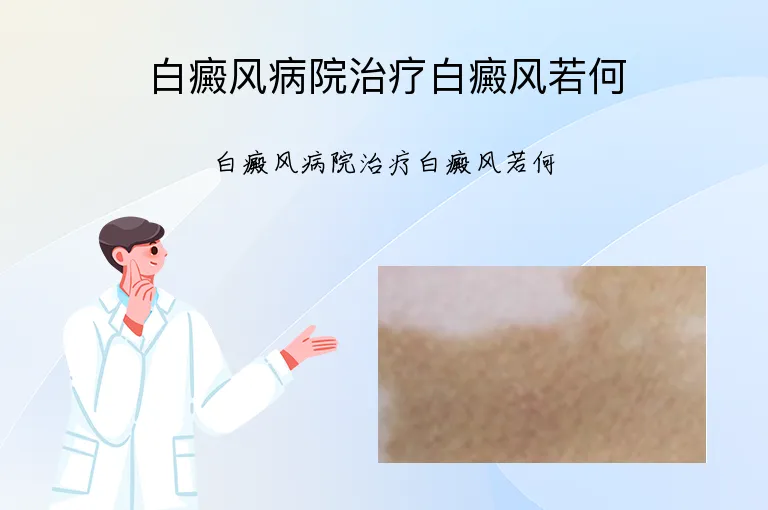 白癜风病院治疗白癜风若何