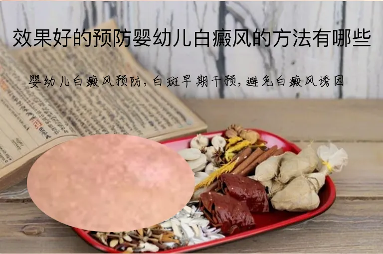 效果好的预防婴幼儿白癜风的方法有哪些