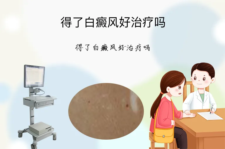 得了白癜风好治疗吗