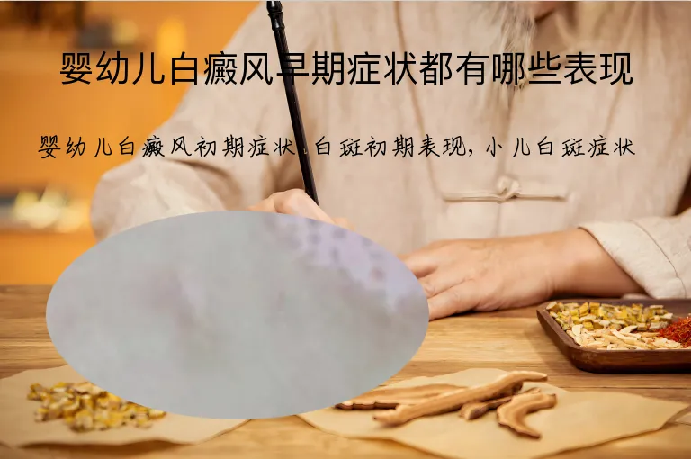 婴幼儿白癜风早期症状都有哪些表现