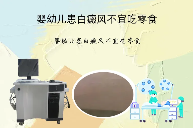 婴幼儿患白癜风不宜吃零食