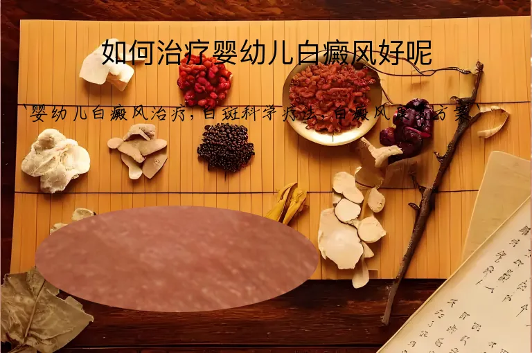 如何治疗婴幼儿白癜风好呢