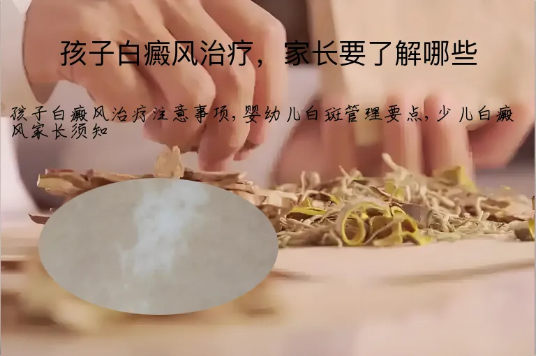 孩子白癜风治疗，家长要了解哪些