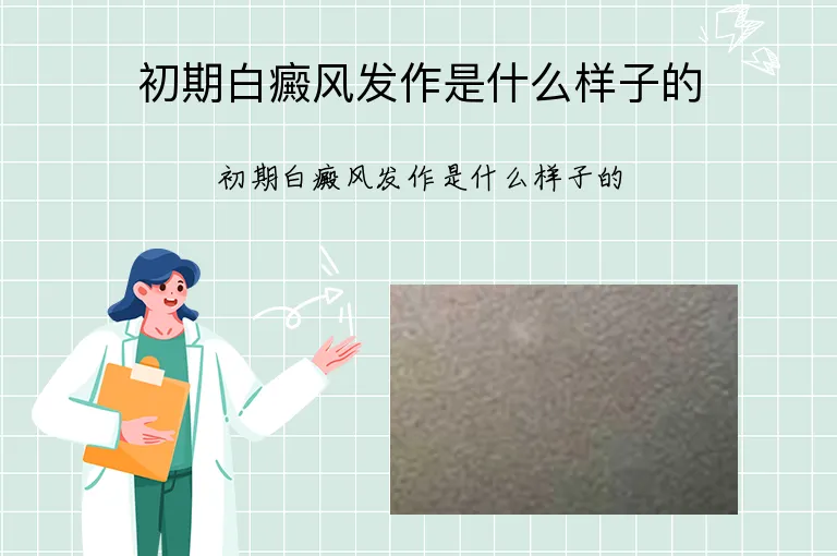 初期白癜风发作是什么样子的