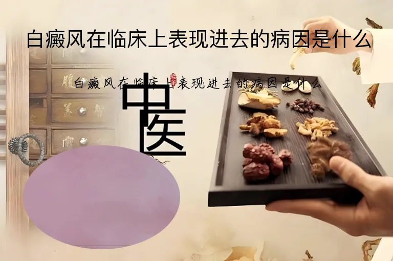 白癜风在临床上表现进去的病因是什么
