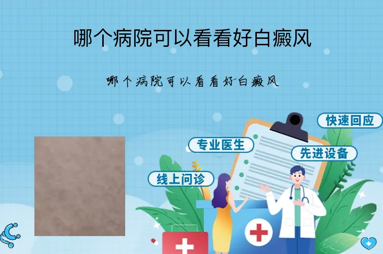 哪个病院可以看看好白癜风