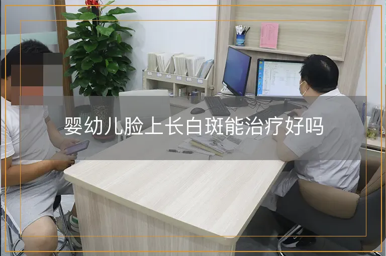 婴幼儿脸上长白斑能治疗好吗