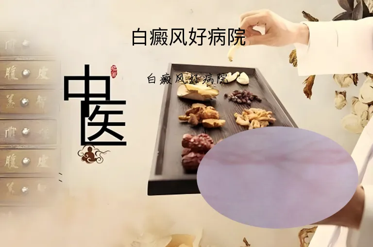 白癜风好病院