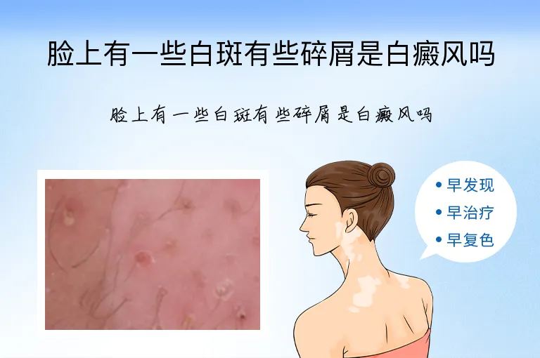 脸上有一些白斑有些碎屑是白癜风吗